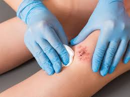 Wound Care